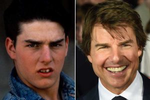 Tom Cruise Teeth