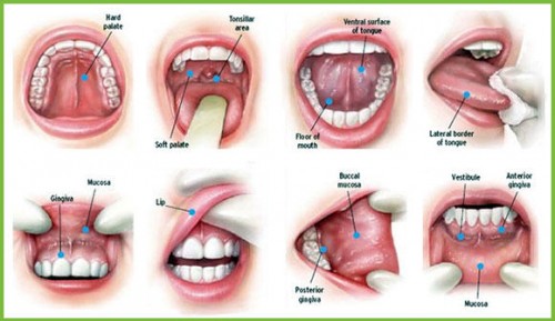 checkingmouthcancer
